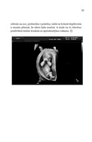 A101I0F0005432_mina-jablko-ze-stromu-asp