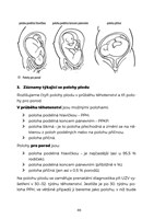 A101B0N0006787_K-porodu-bez-obav_list2.j