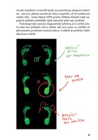 A101B0N0013701_Zdrava-chodila-zdrava-zad